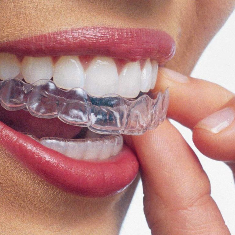 7. Orthodontics