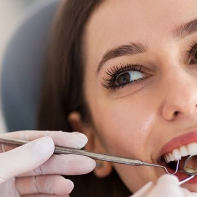 composite-fillings-in-bridlewood
